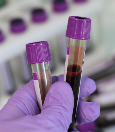 BPL製作イメージ